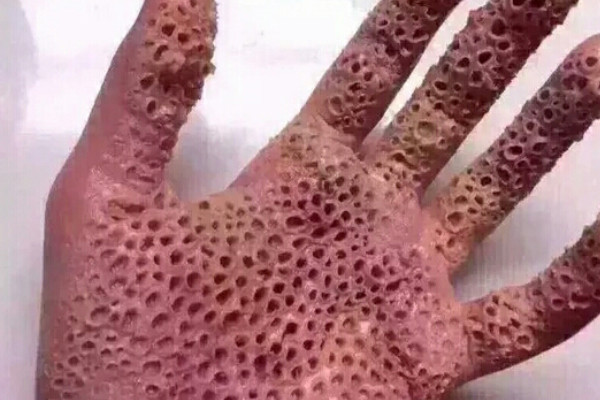 密密麻麻的意思